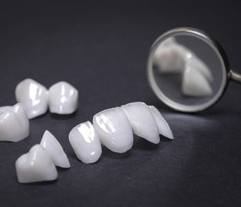 picture of a variety of metal-free restorations