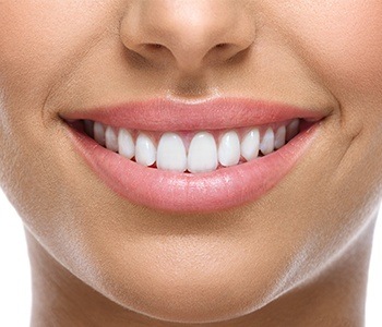 Closeup of flawless cosmetic dental smile
