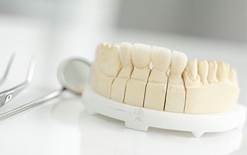 Model smile with dental crown