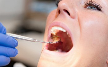 open mouth dentist
