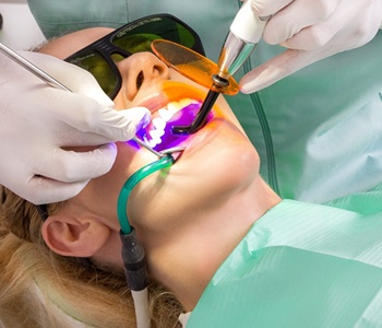 A woman having porcelain veneers placed